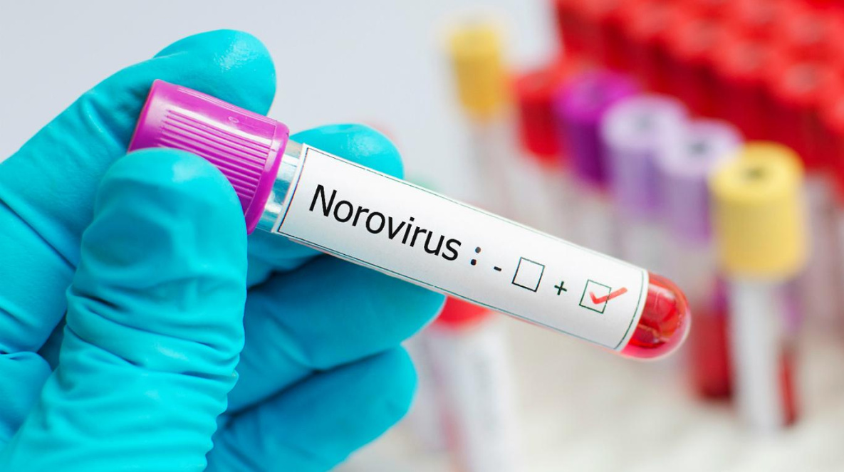 Вспышку норовируса ликвидировали в детском интернате Хабаровска